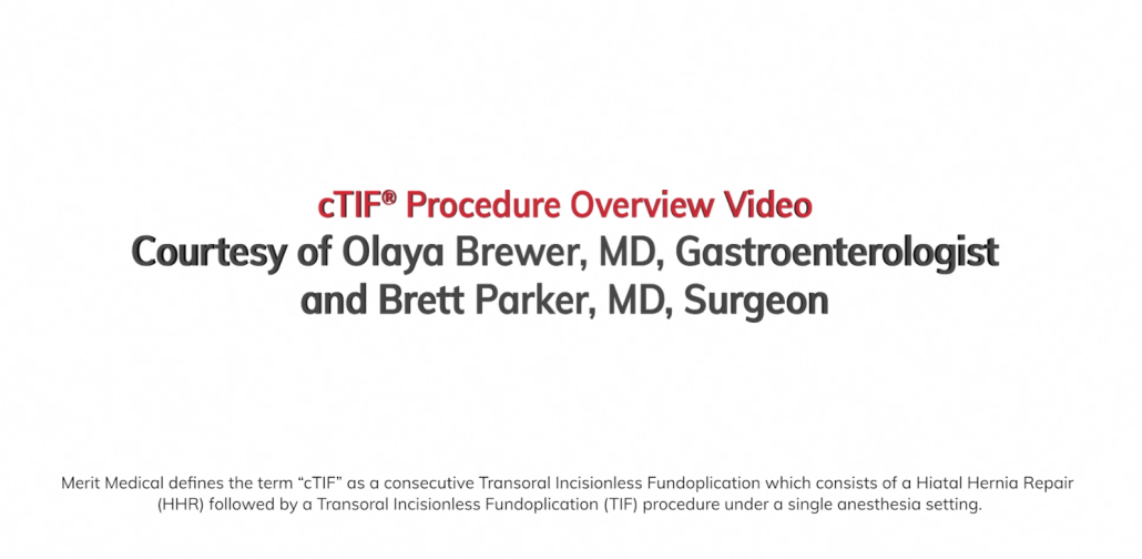 cTIF Procedure Video from Brewer/Parker